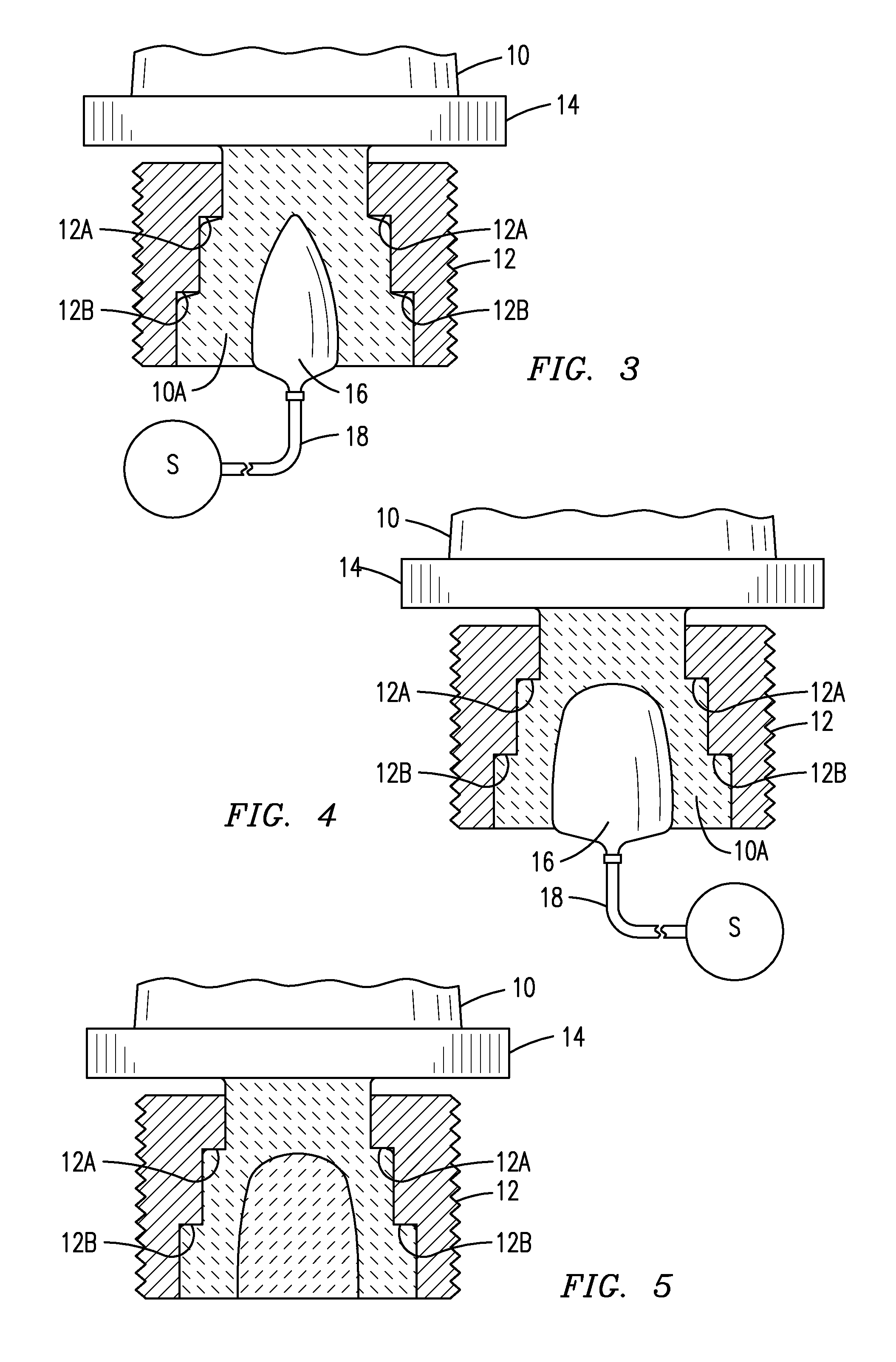 Composite Blade and Method of Manufacture