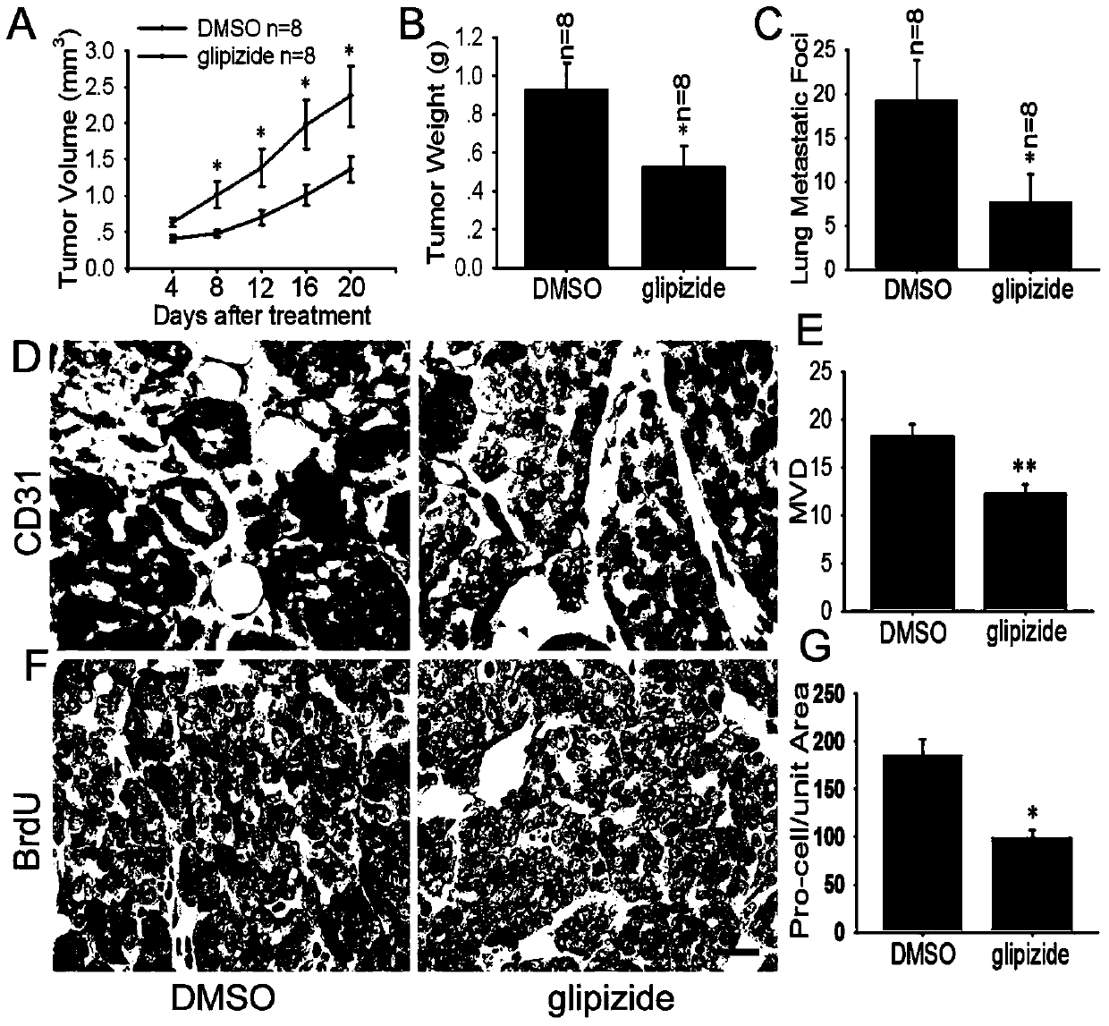 Application of glipizide in preparing medicine for treating tumors