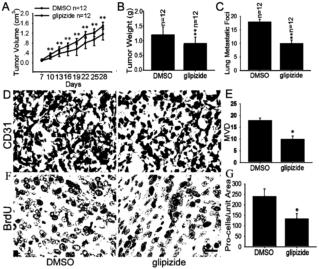 Application of glipizide in preparing medicine for treating tumors