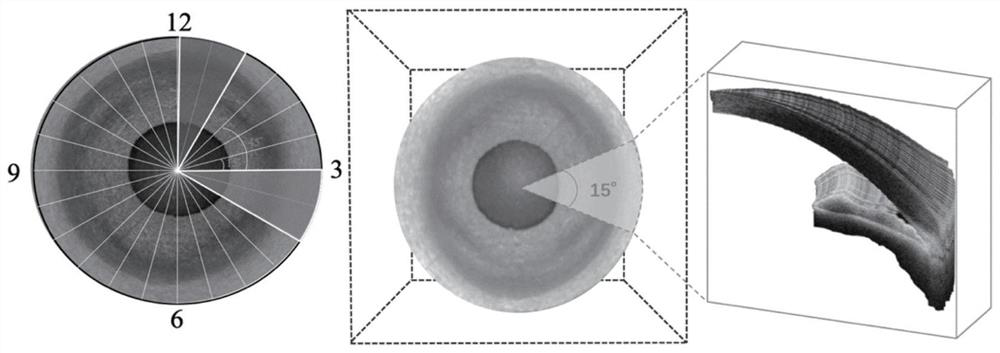 A method for angle classification of as-oct images based on convolutional recurrent neural network