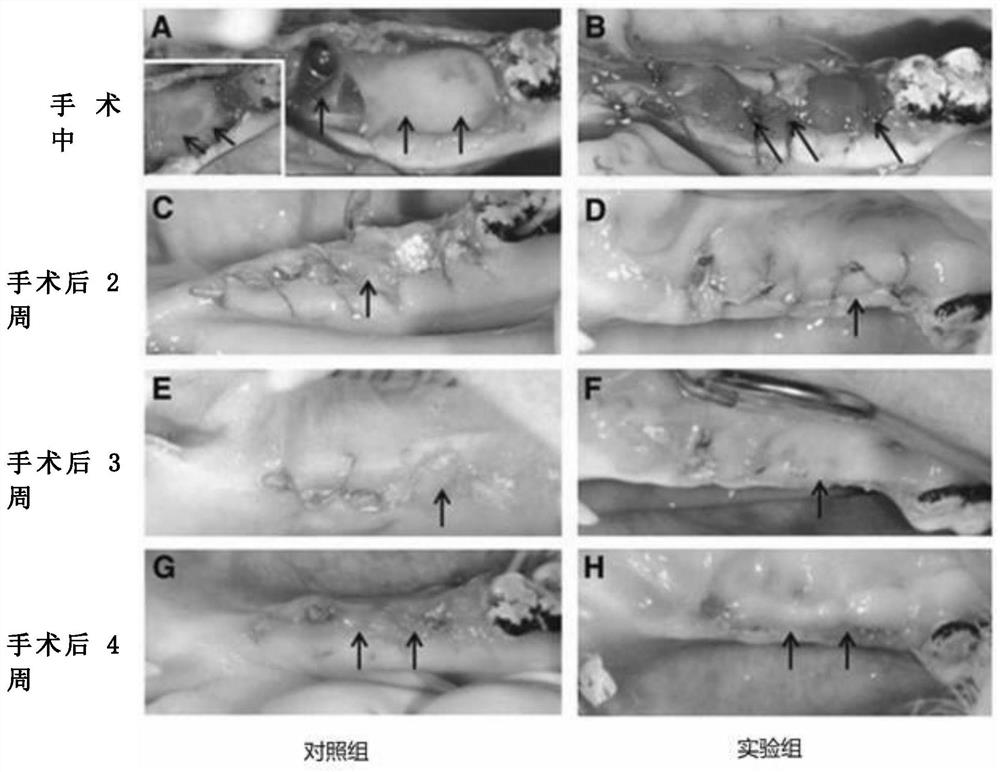 Barrier membrane for guided bone regeneration and its preparation method