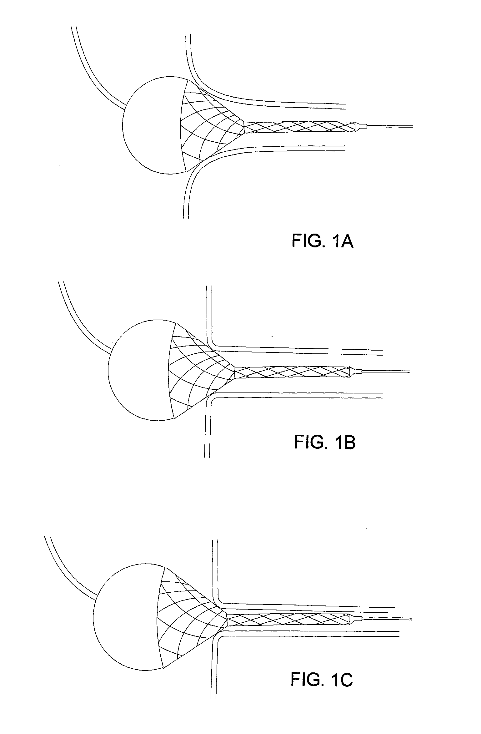 Steep-taper flared stents and apparatus and methods for delivering them