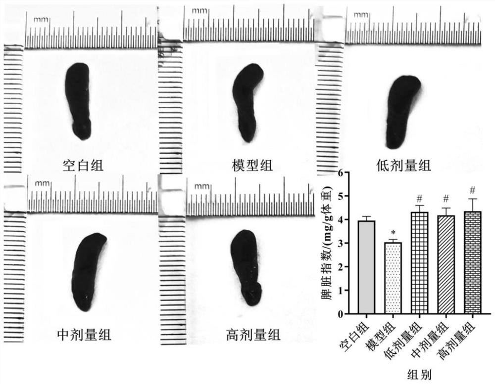 Application of active polysaccharide in preparation of immunity enhancing medicine, pharmaceutical composition or health food