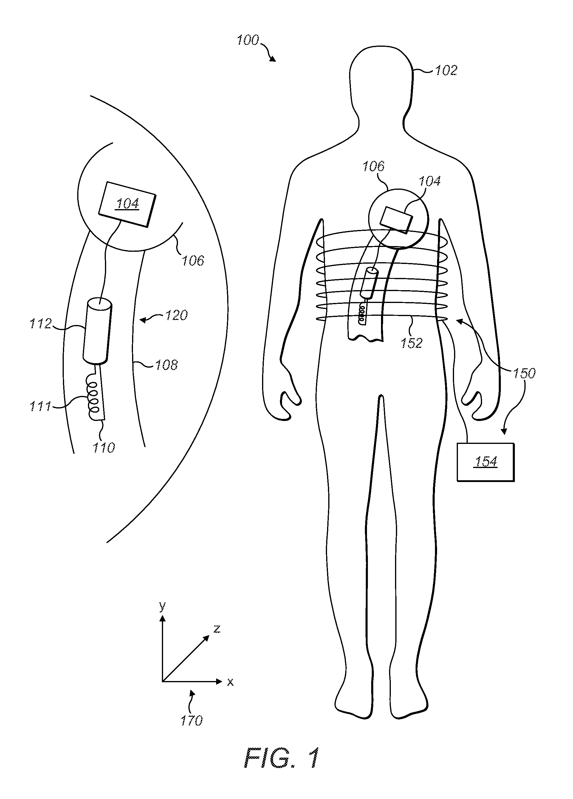 System and method for contactless power transfer in implantable devices