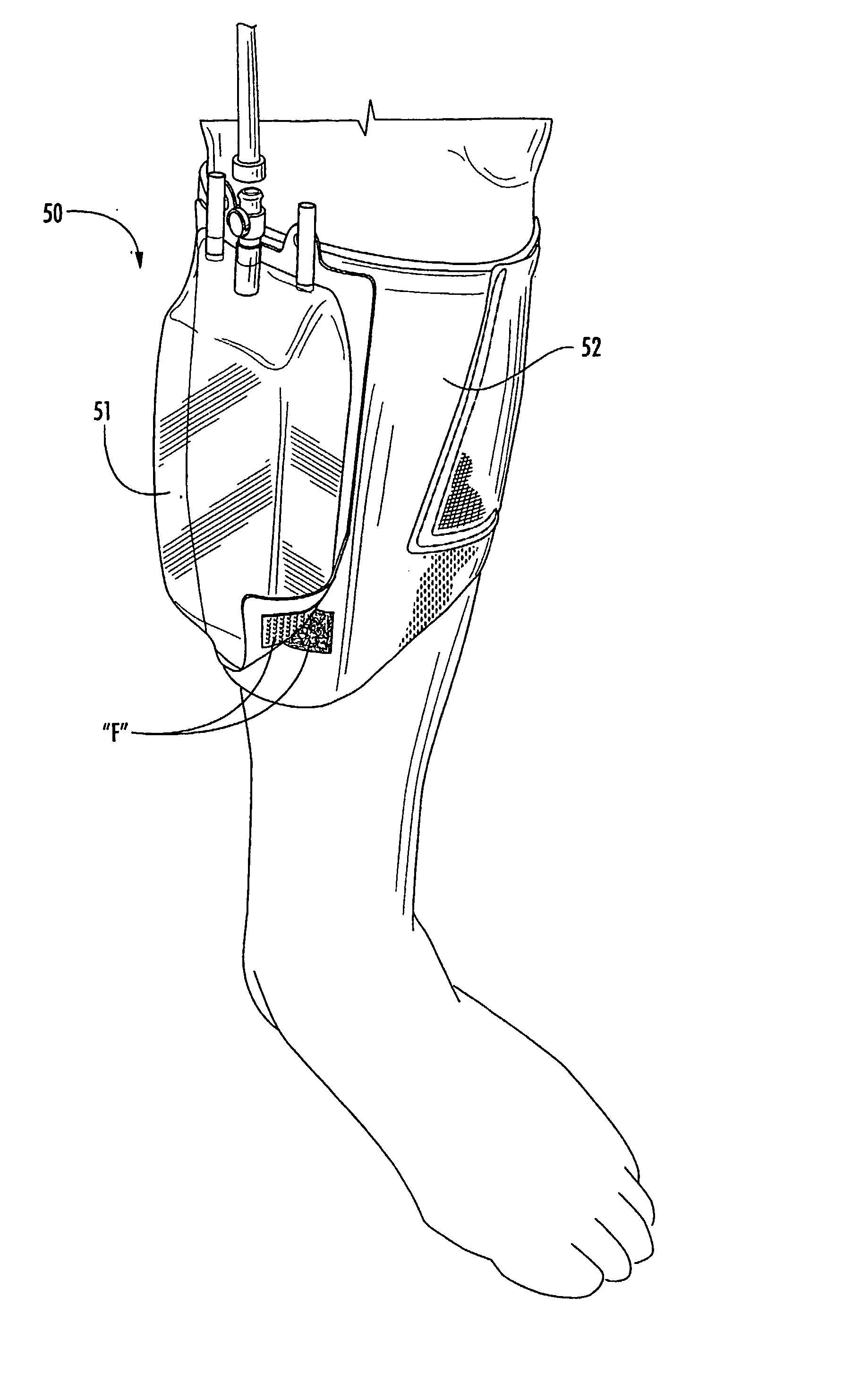 Flexible Bag Wrap Adapted For Use In An Incontinence Management System