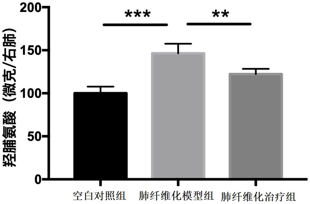 Application of darunavir in preparation of medicine for treating pulmonary fibrosis diseases