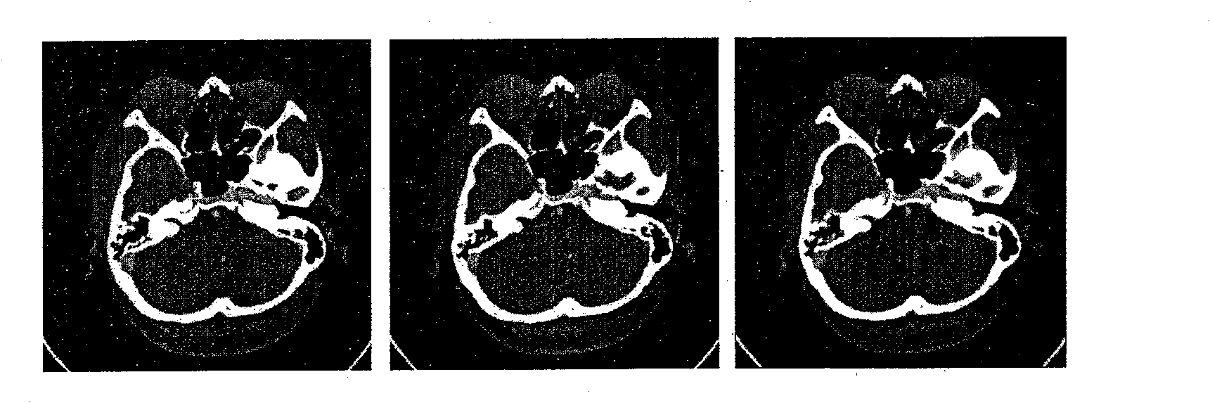 Self-adapting medicine sequence image values interpolation method based on interested region