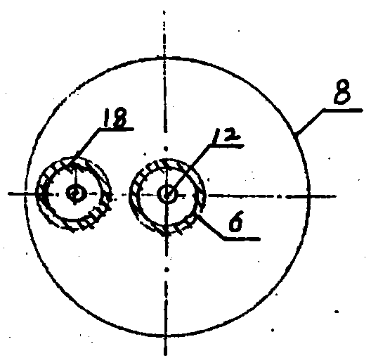 Cervical cancer internal radiation therapy device