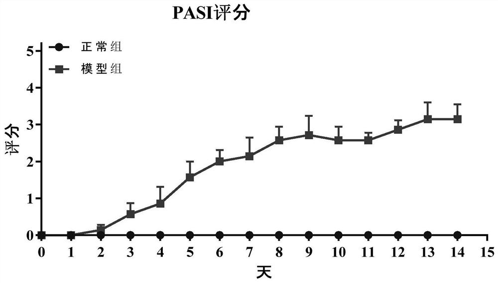 Psoriasis animal model and construction method and application thereof