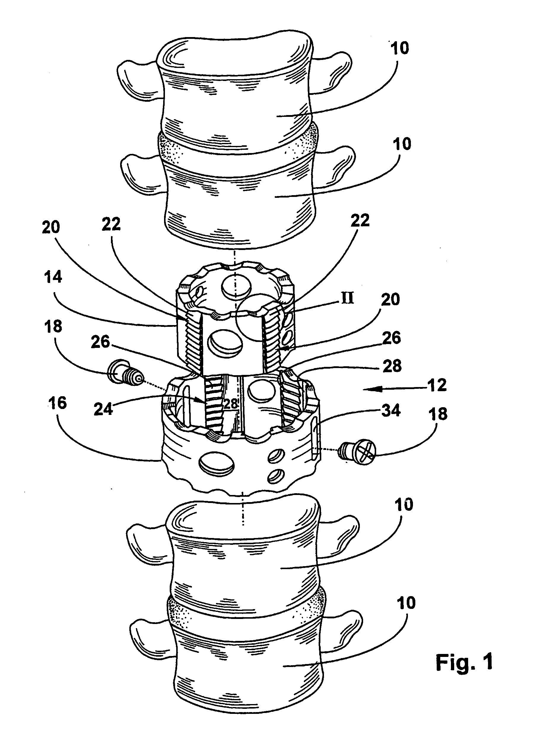 Vertebral body placeholder