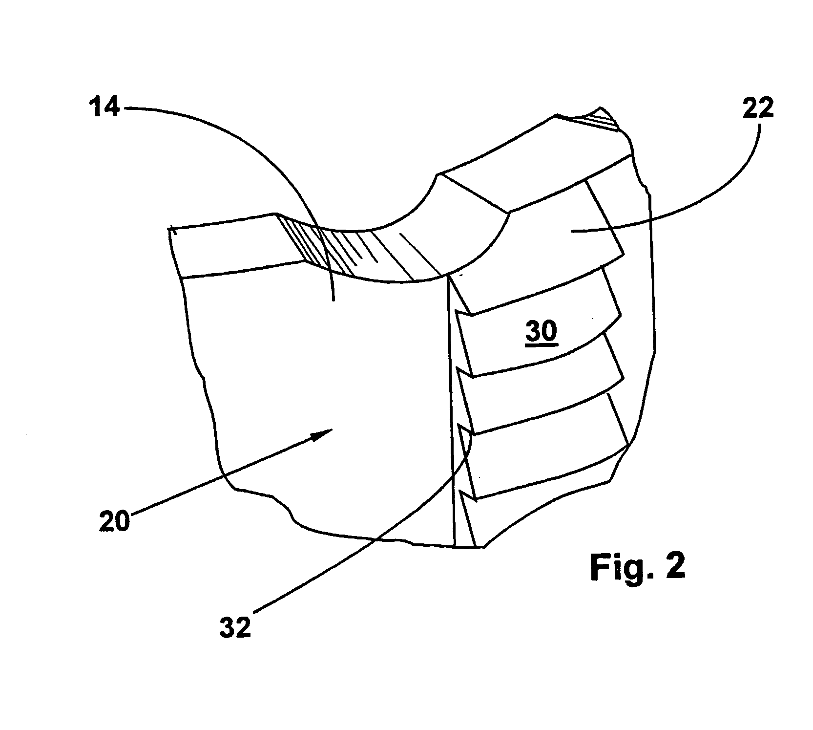 Vertebral body placeholder