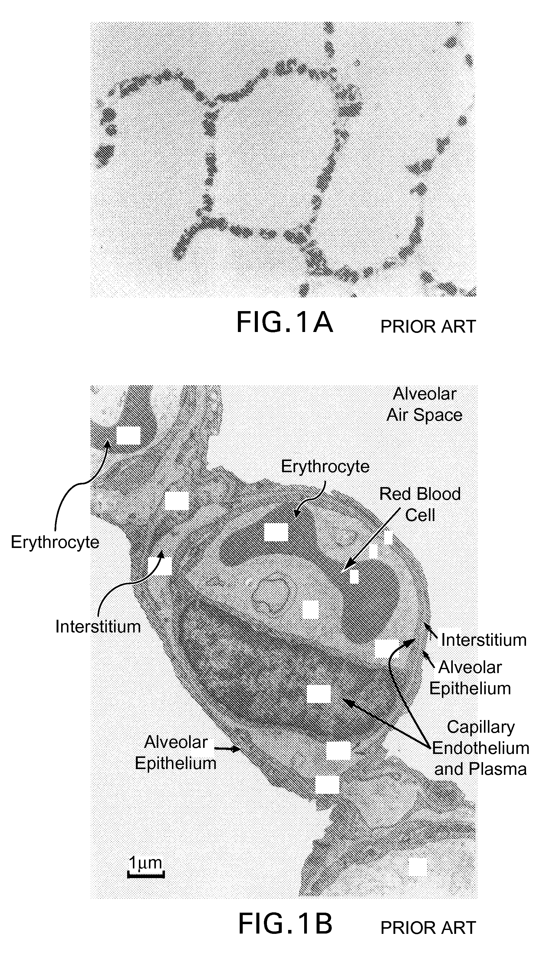 Methods for In Vivo Evaluation of Pulmonary Physiology And/Or Function Using NMR Signals of Polarized 129Xe