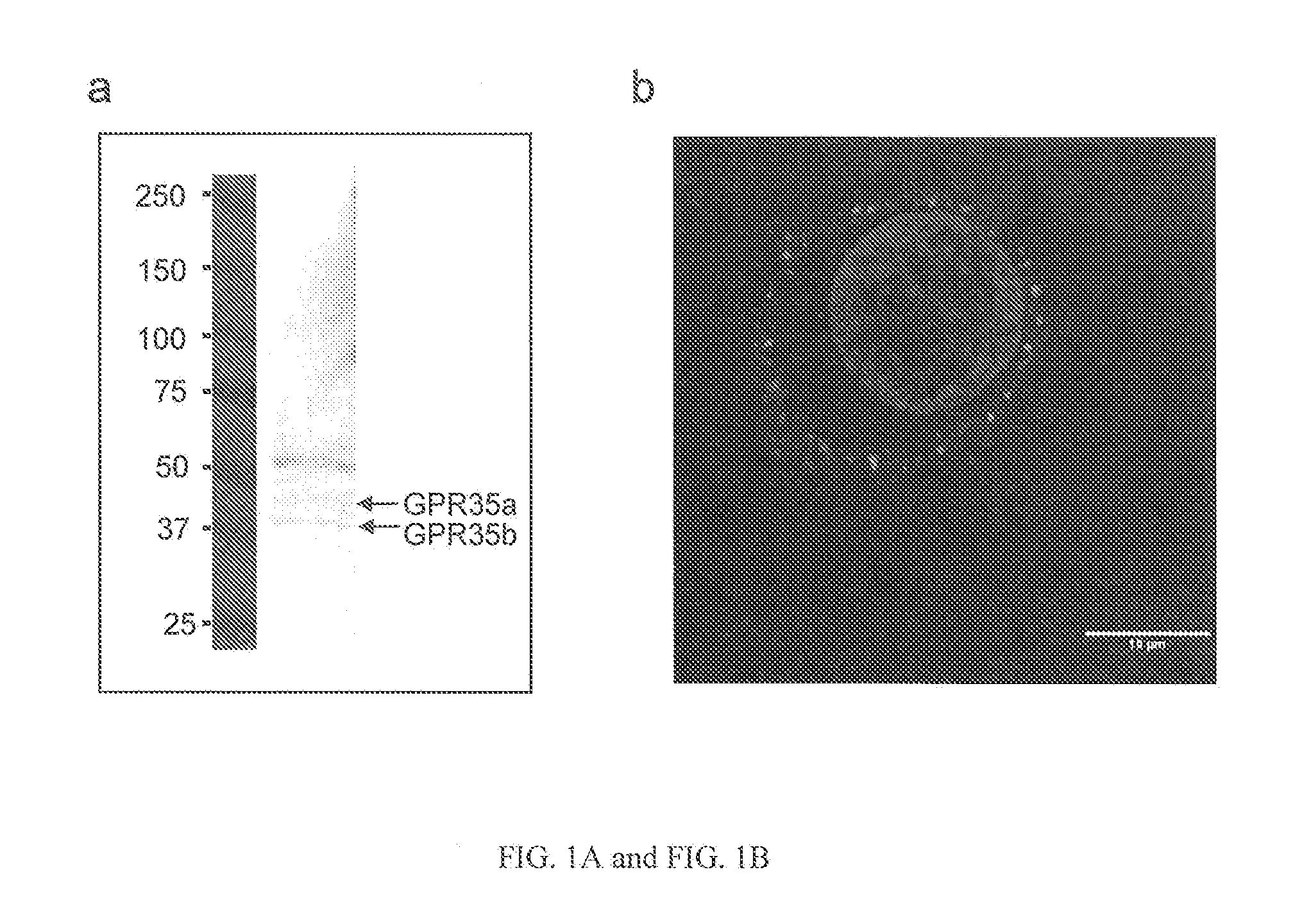 Compositions and methods for the treatment of pathological condition(s) related to GPR35 and/or GPR35-herg complex