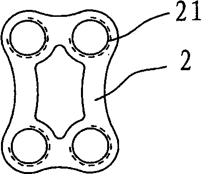 Minimally invasive dual-locking implantation system for cervical vertebra