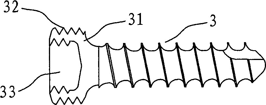 Minimally invasive dual-locking implantation system for cervical vertebra