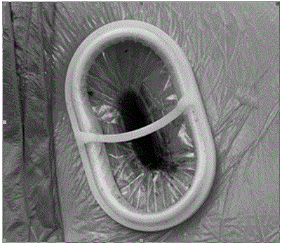 Single-port thoracoscopic surgery operation platform