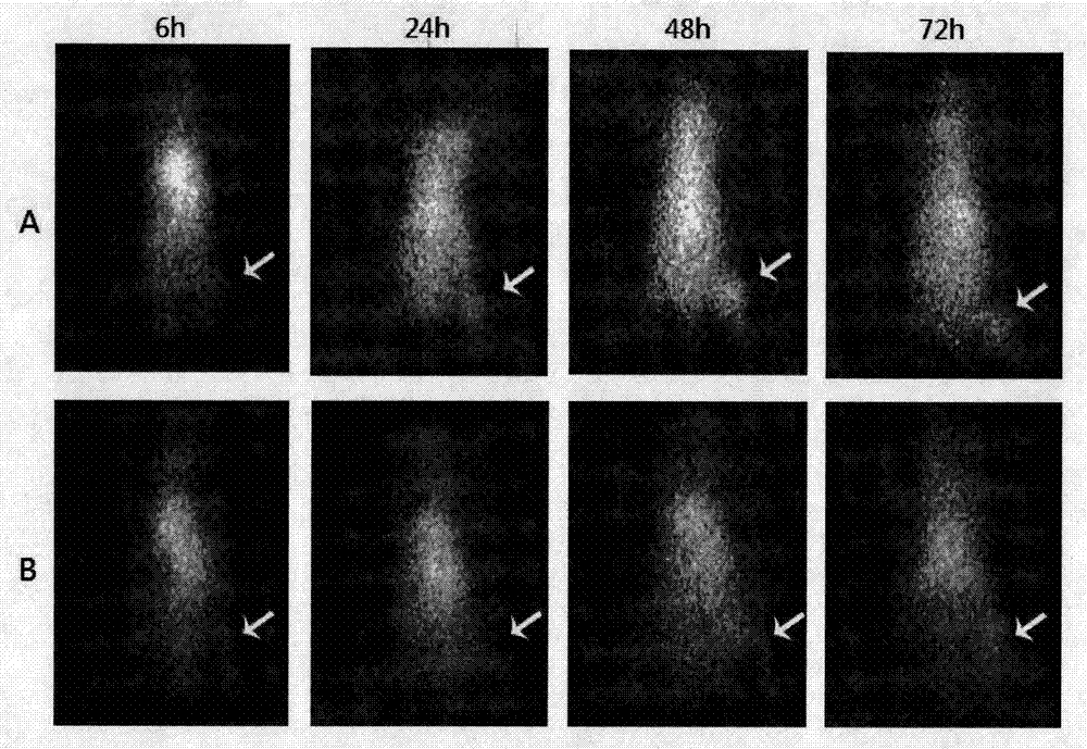 I&lt;131&gt; labeled anti-human neuropilin receptor-2 monoclonal antibody E4 and application thereof