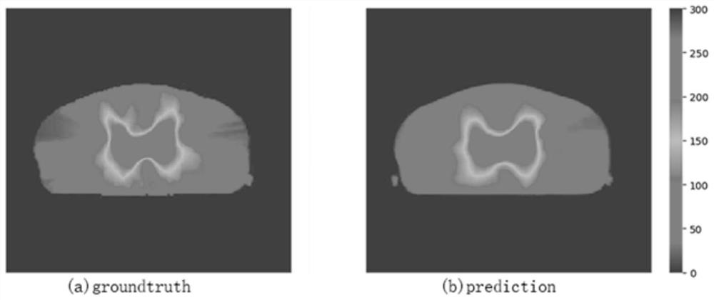 Three-dimensional dose distribution prediction method for nasopharyngeal carcinoma based on segmentation task