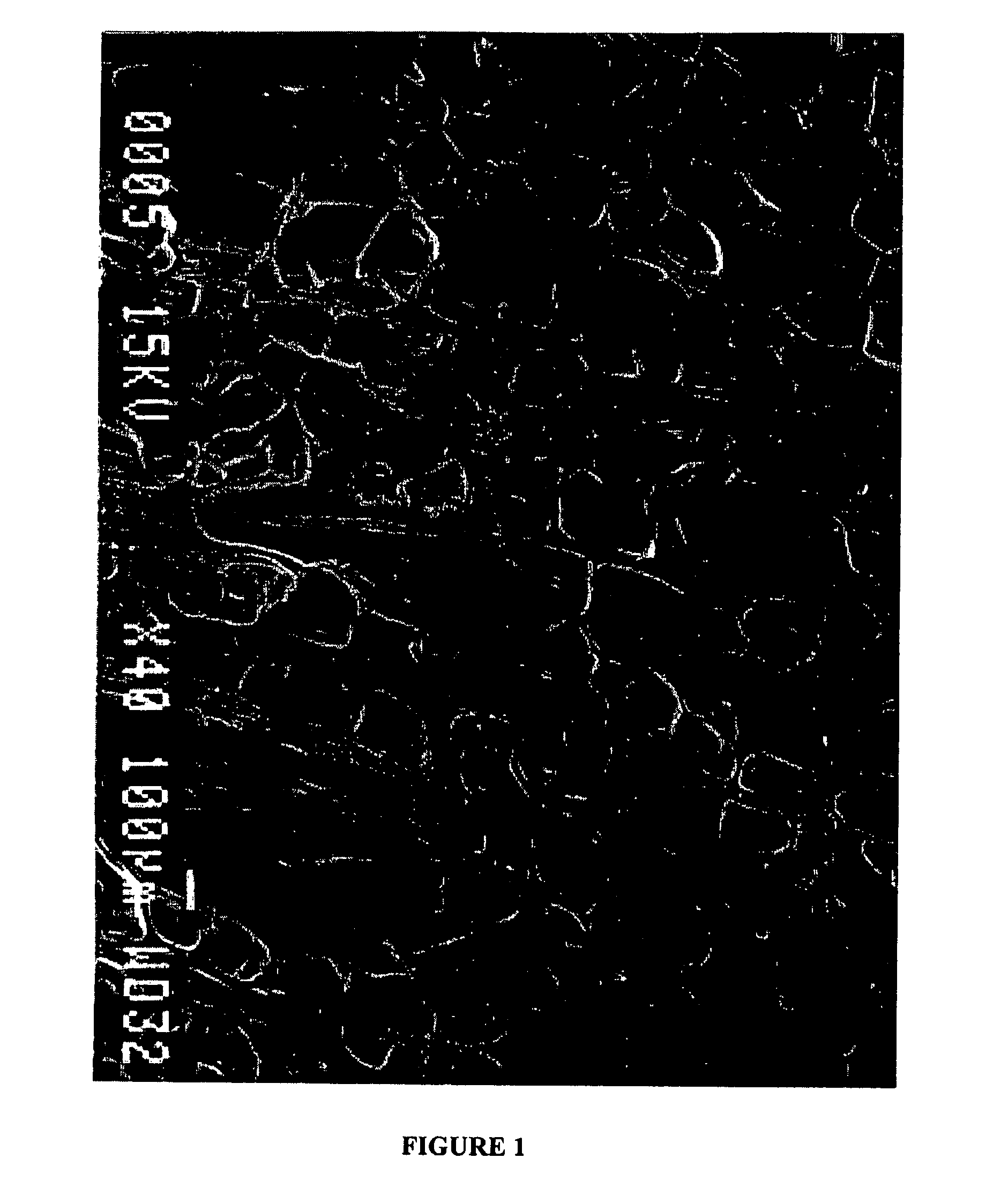 Fiber-reinforced, porous, biodegradable implant device