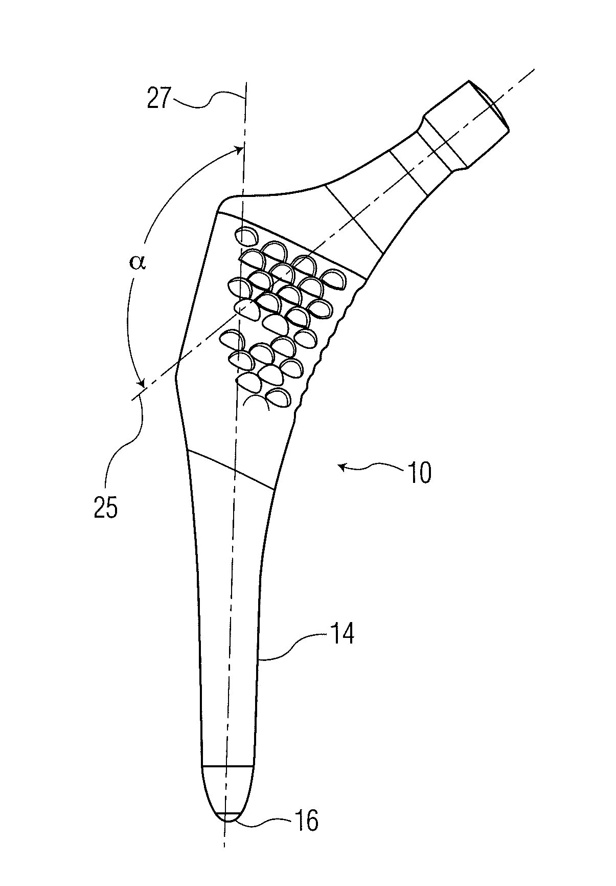 Anatomic monolithic hip implant system