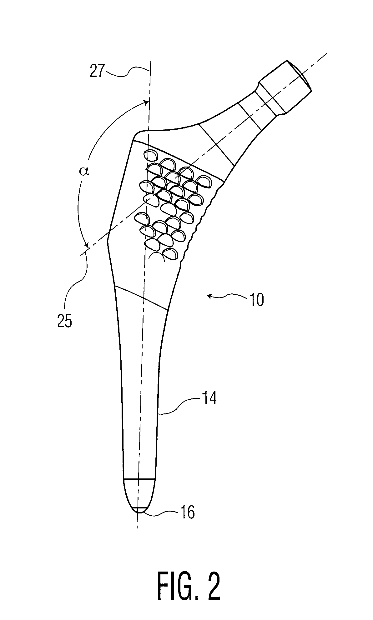 Anatomic monolithic hip implant system