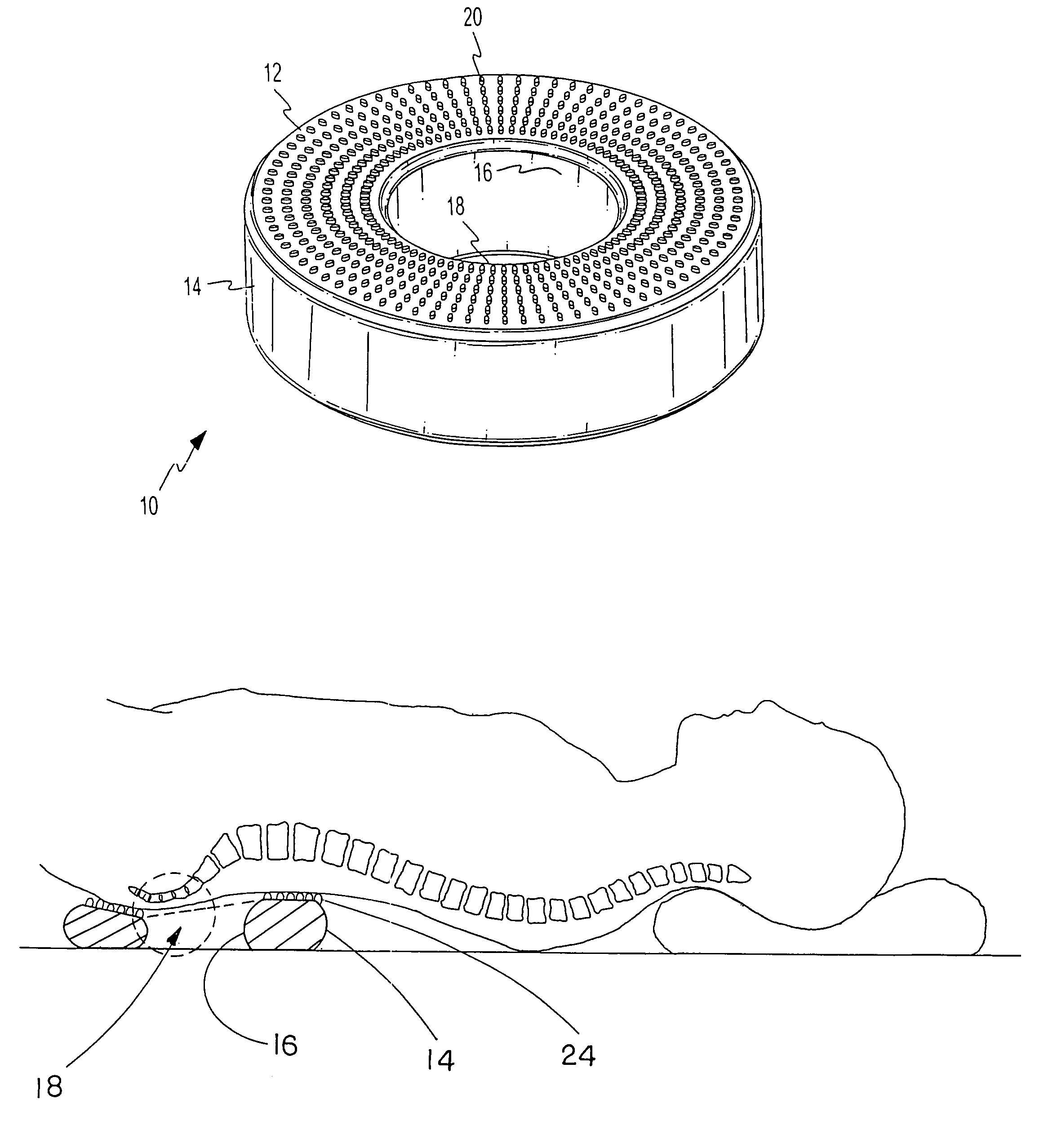 Cushion to support patient with bed sores