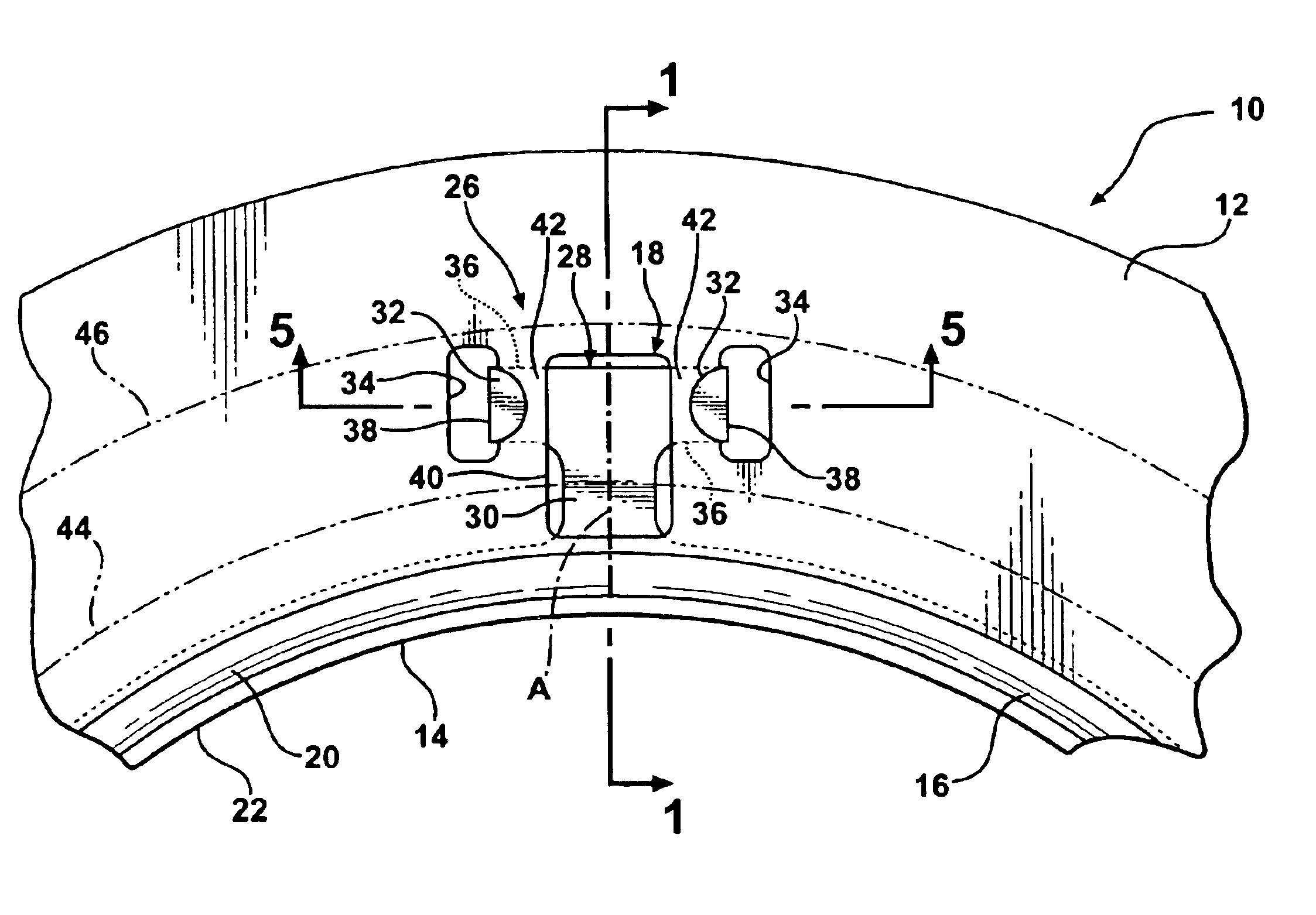 Metal gasket