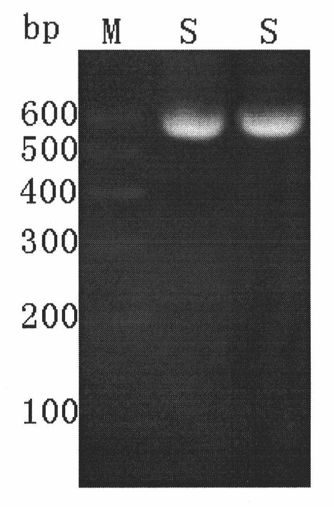 Rana chensinensis functional gene Rd-RNase3 sequence, construction method and amino acid sequence and application thereof