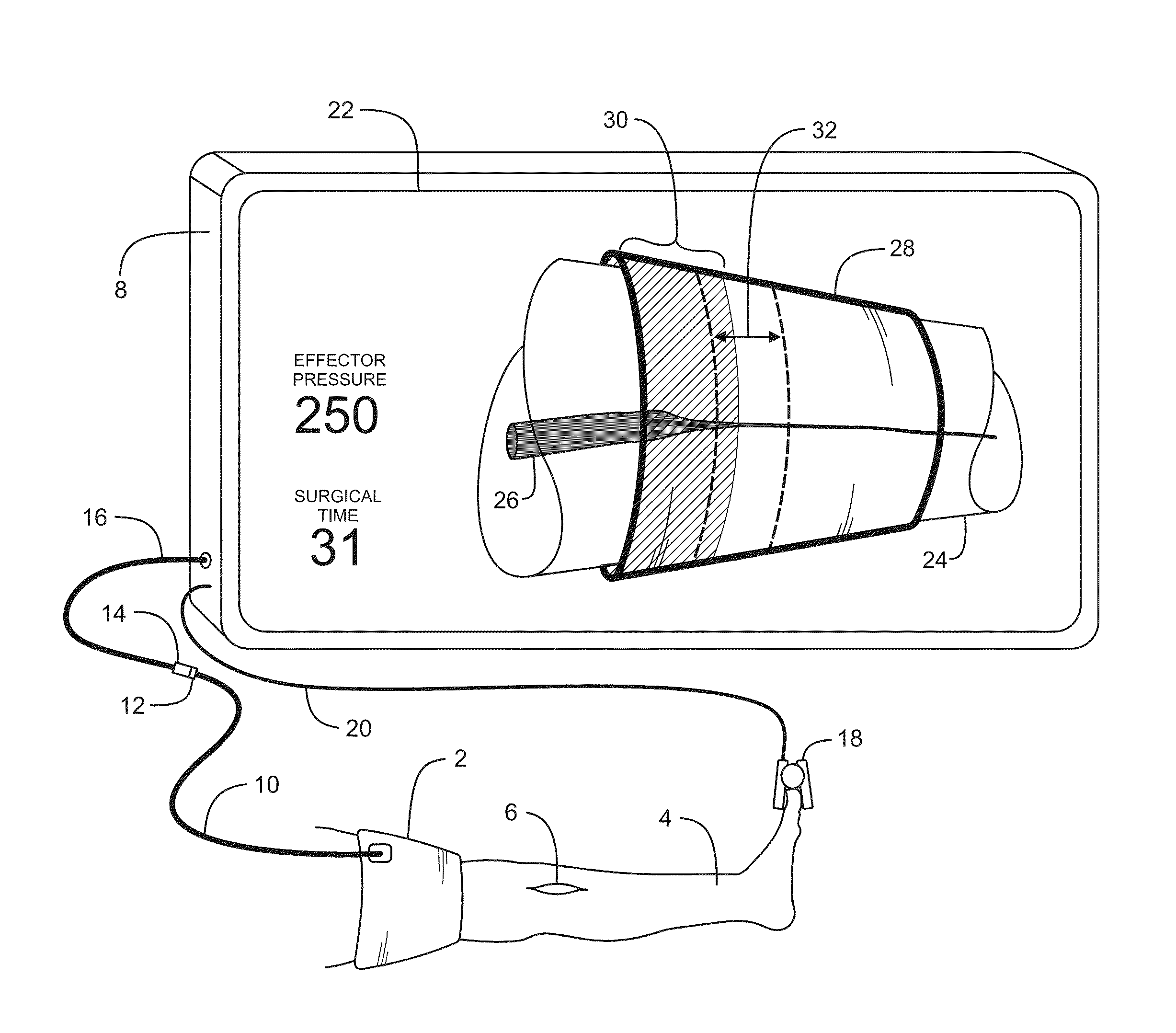 Personalized tourniquet system having dual-purpose cuff