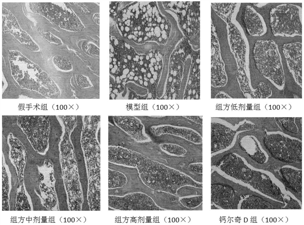 A traditional Chinese medicine active ingredient composition for the treatment of postmenopausal osteoporosis and its application