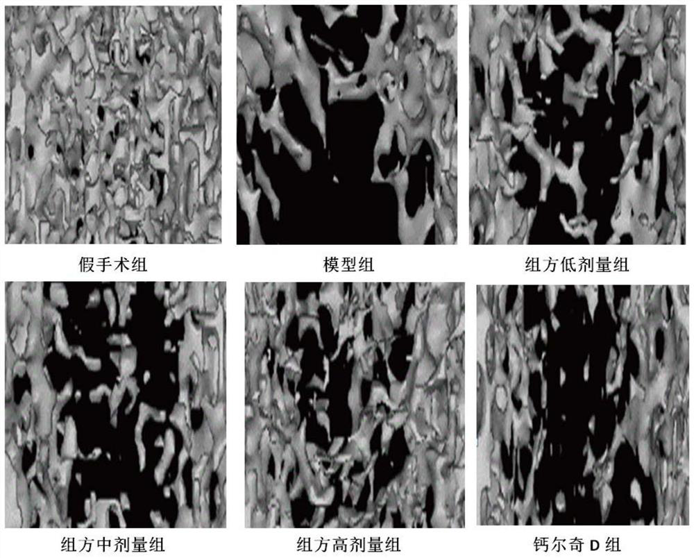 A traditional Chinese medicine active ingredient composition for the treatment of postmenopausal osteoporosis and its application