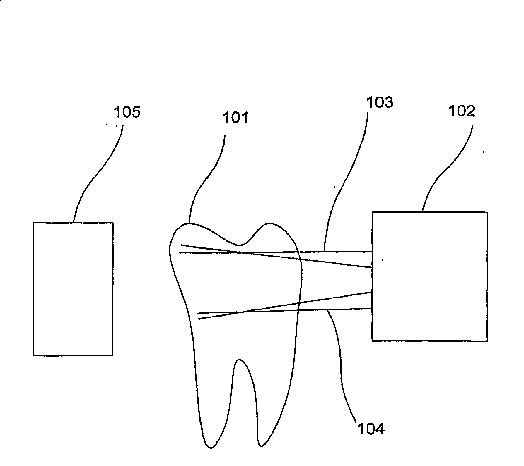 Infrared dental imaging