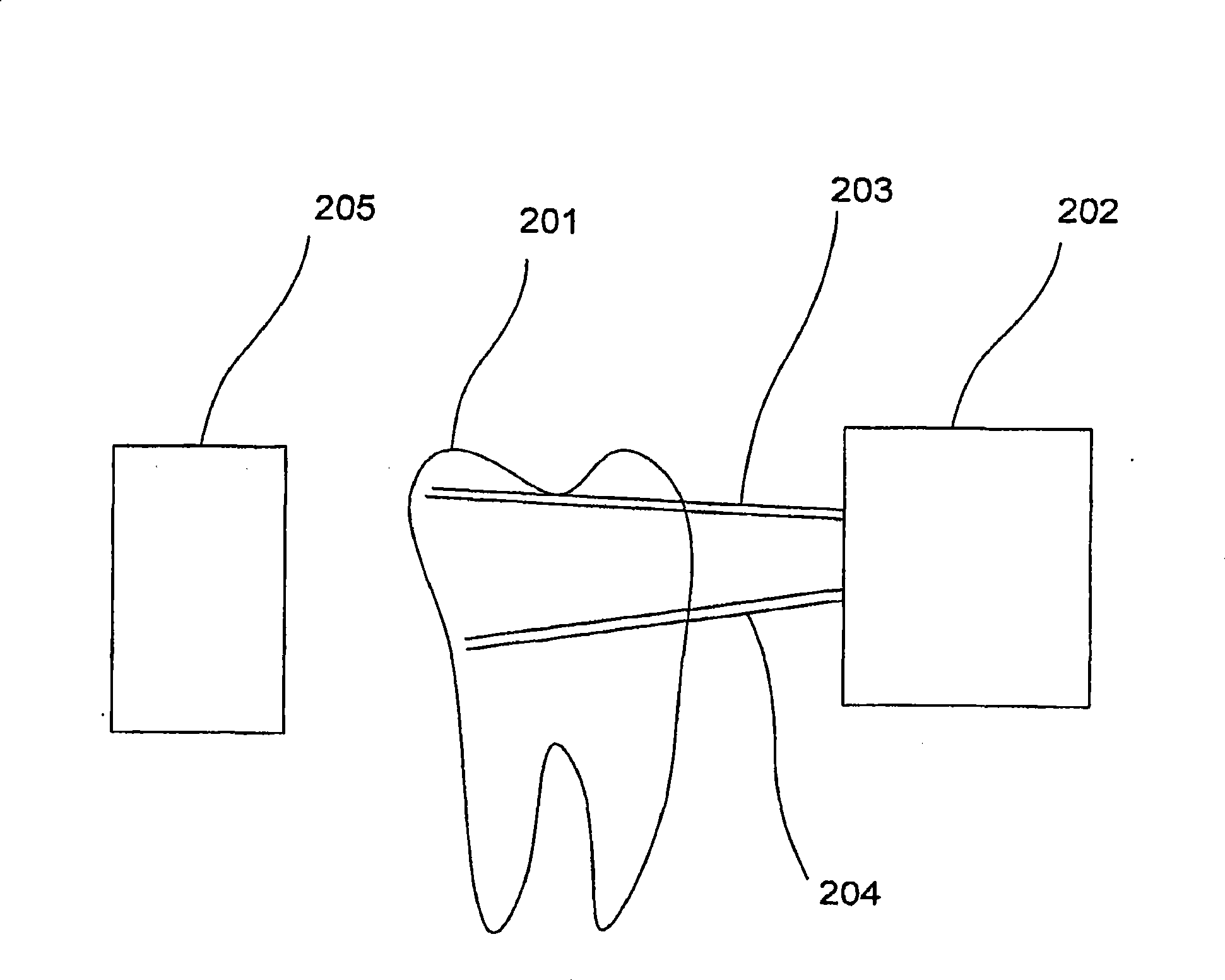 Infrared dental imaging