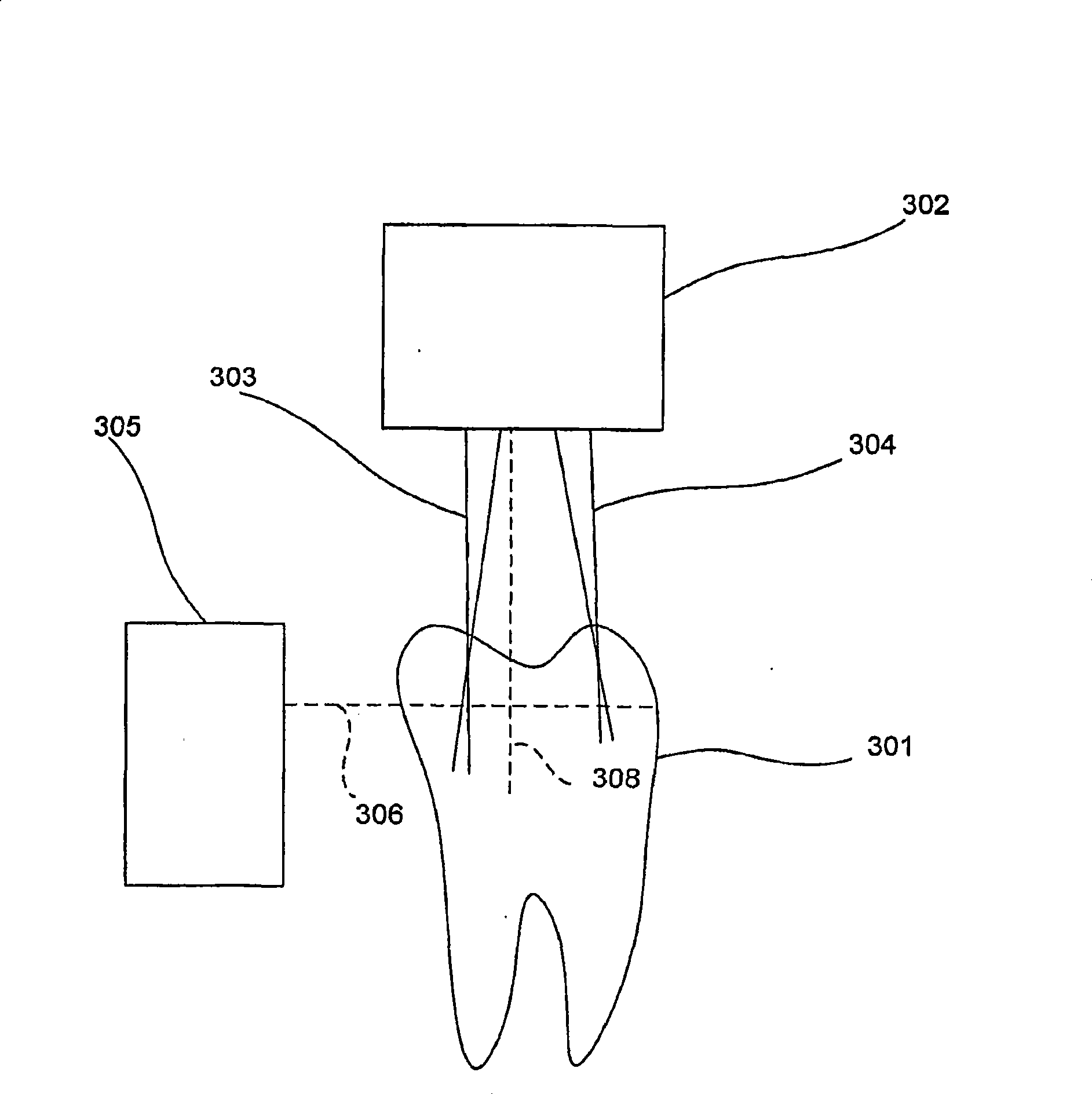 Infrared dental imaging