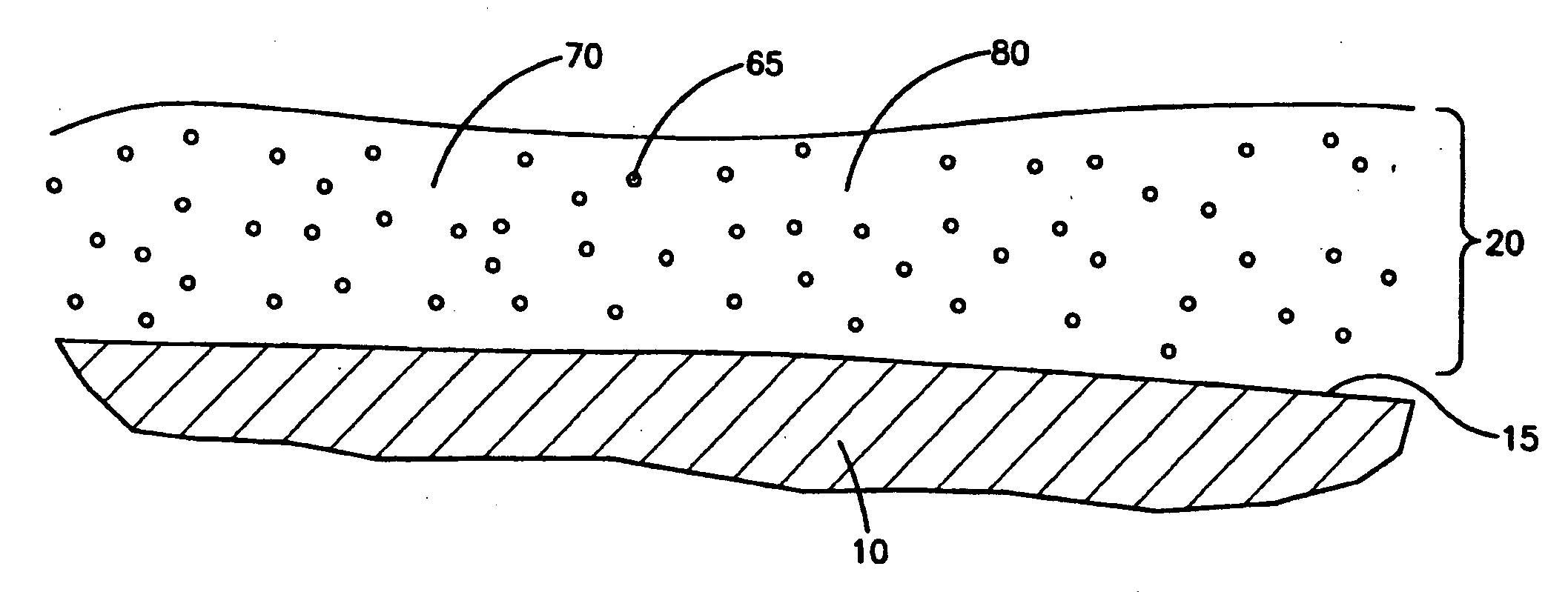 Medical devices with coatings for delivery of a therapeutic agent