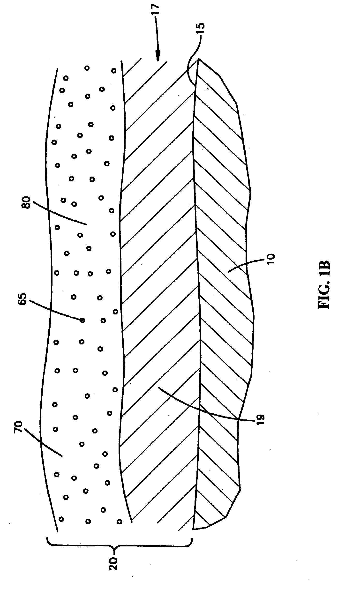 Medical devices with coatings for delivery of a therapeutic agent