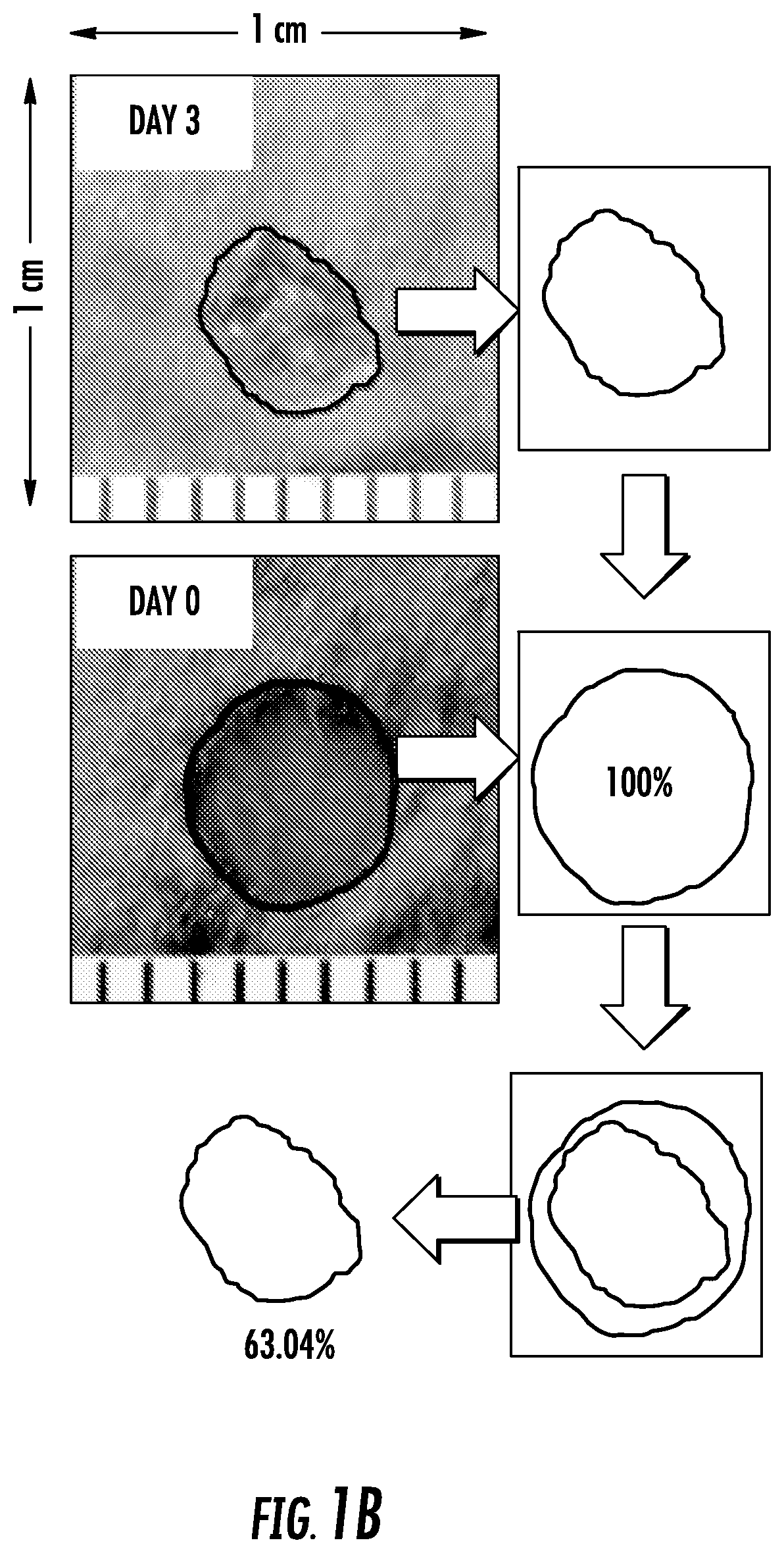 Methods of recruiting SDF-producing macrophages