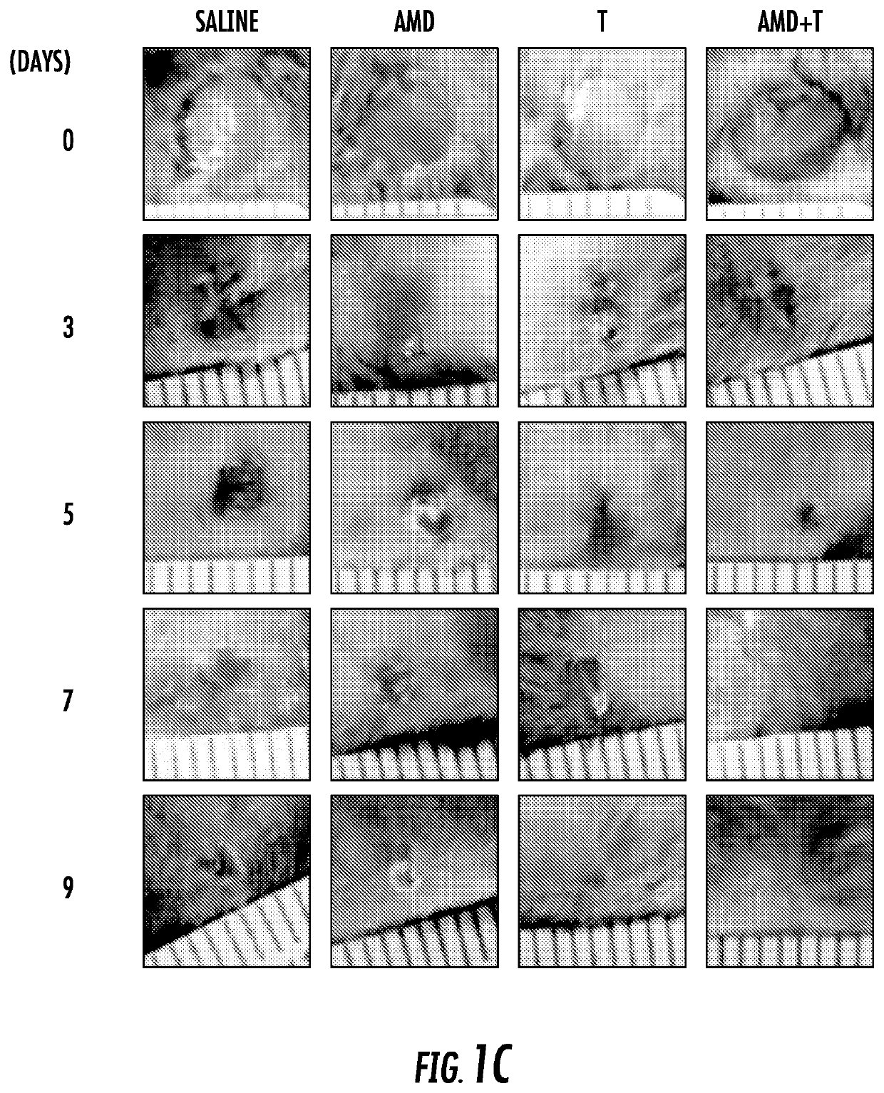 Methods of recruiting SDF-producing macrophages