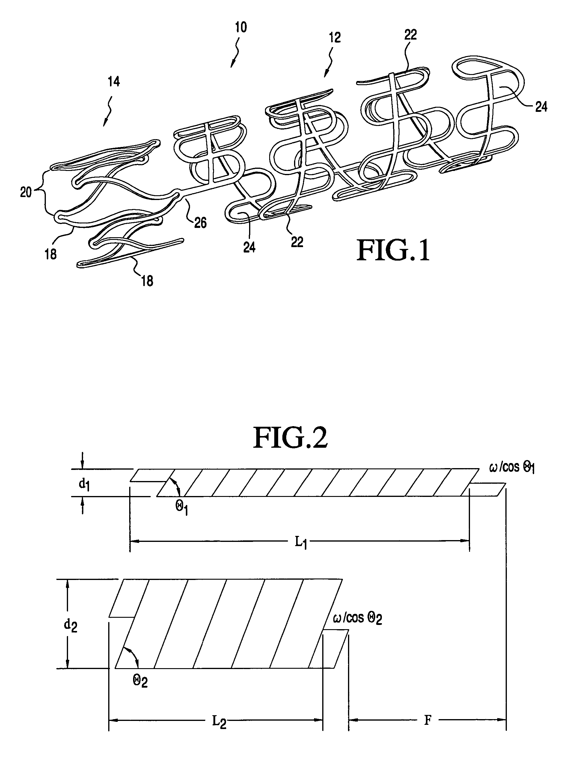 Delivery catheter that controls foreshortening of ribbon-type prostheses and methods of making and use