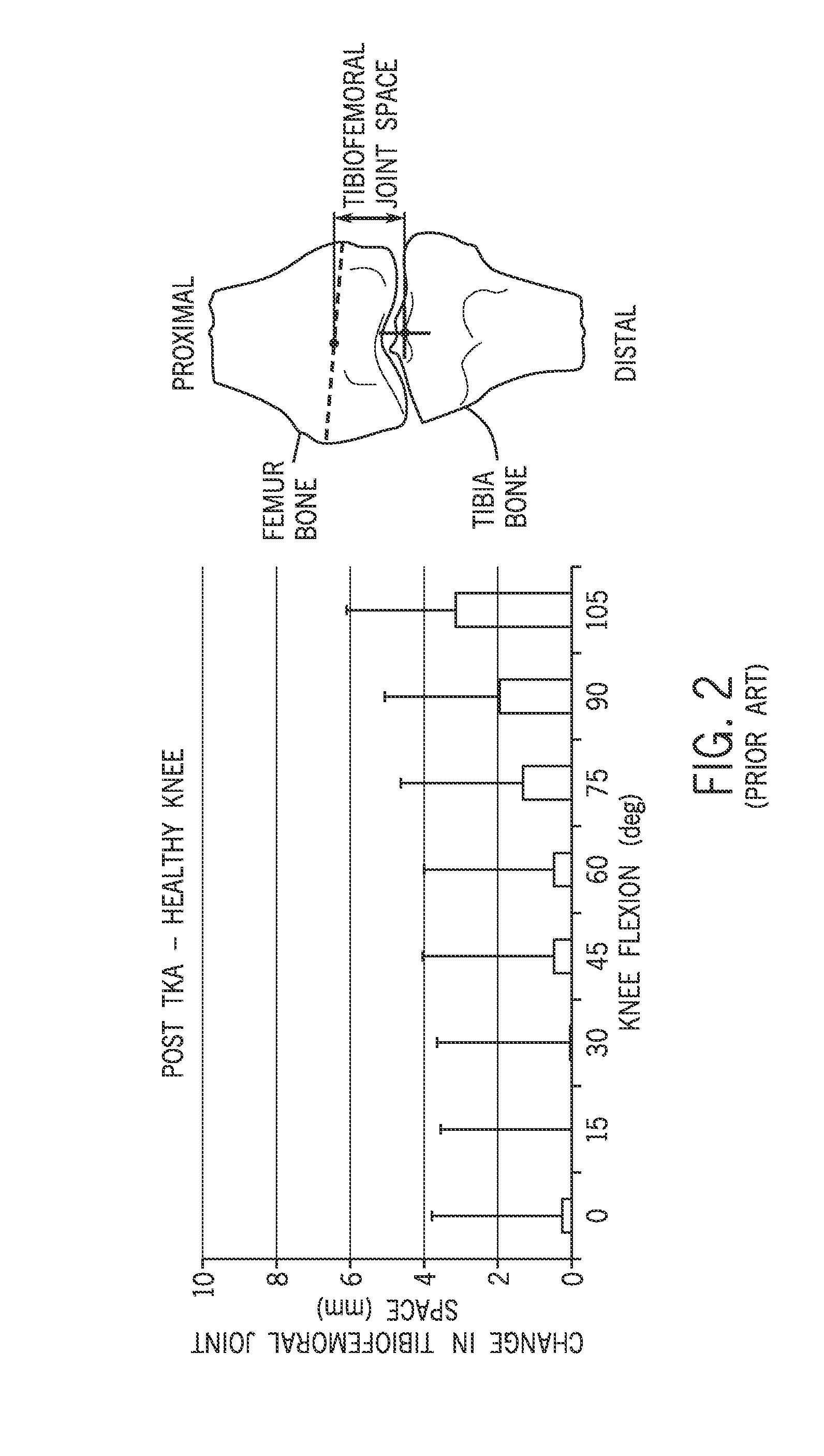 Prosthesis and method for using prosthesis to facilitate deep knee flexion