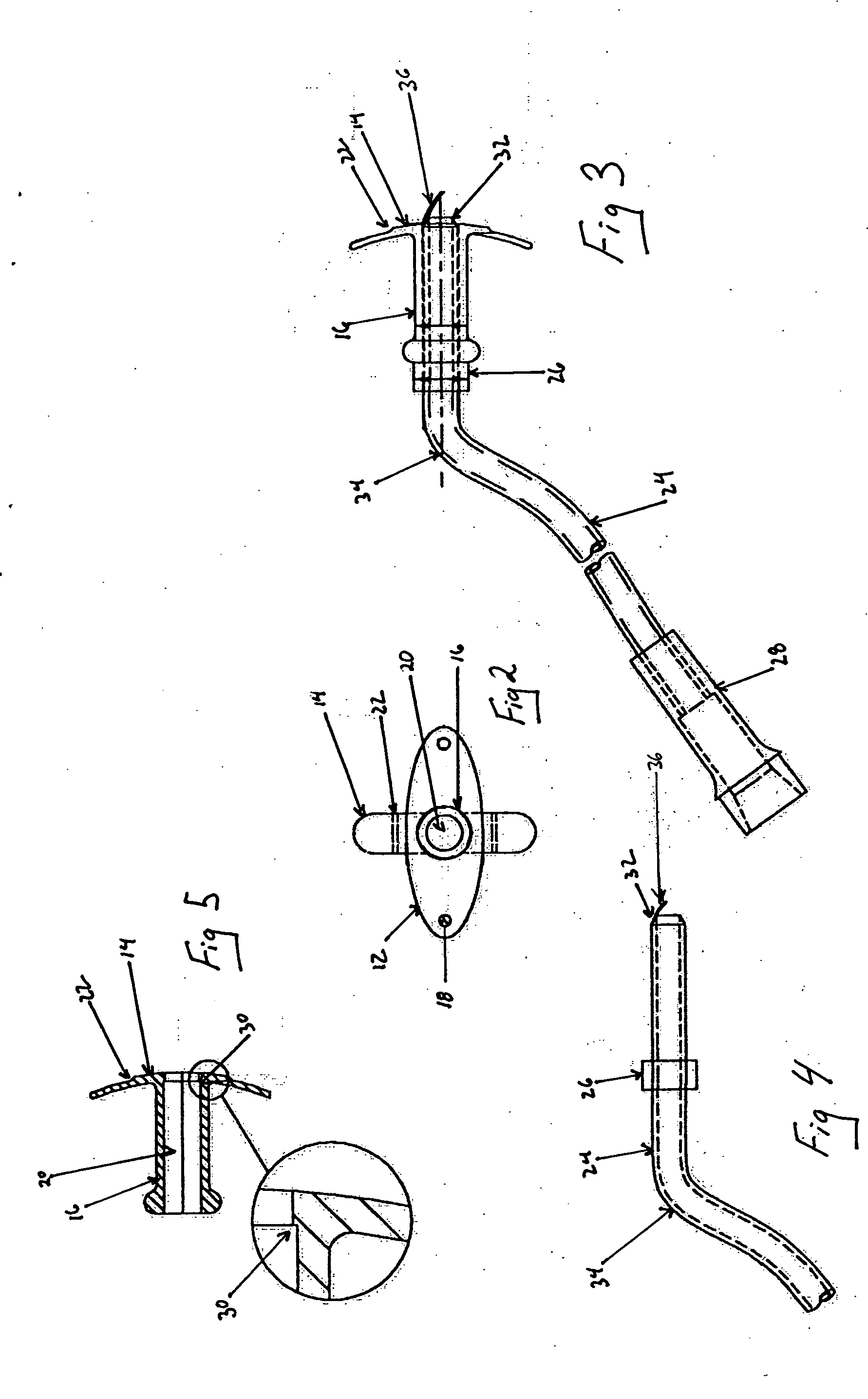 Transtracheal oxygen stent