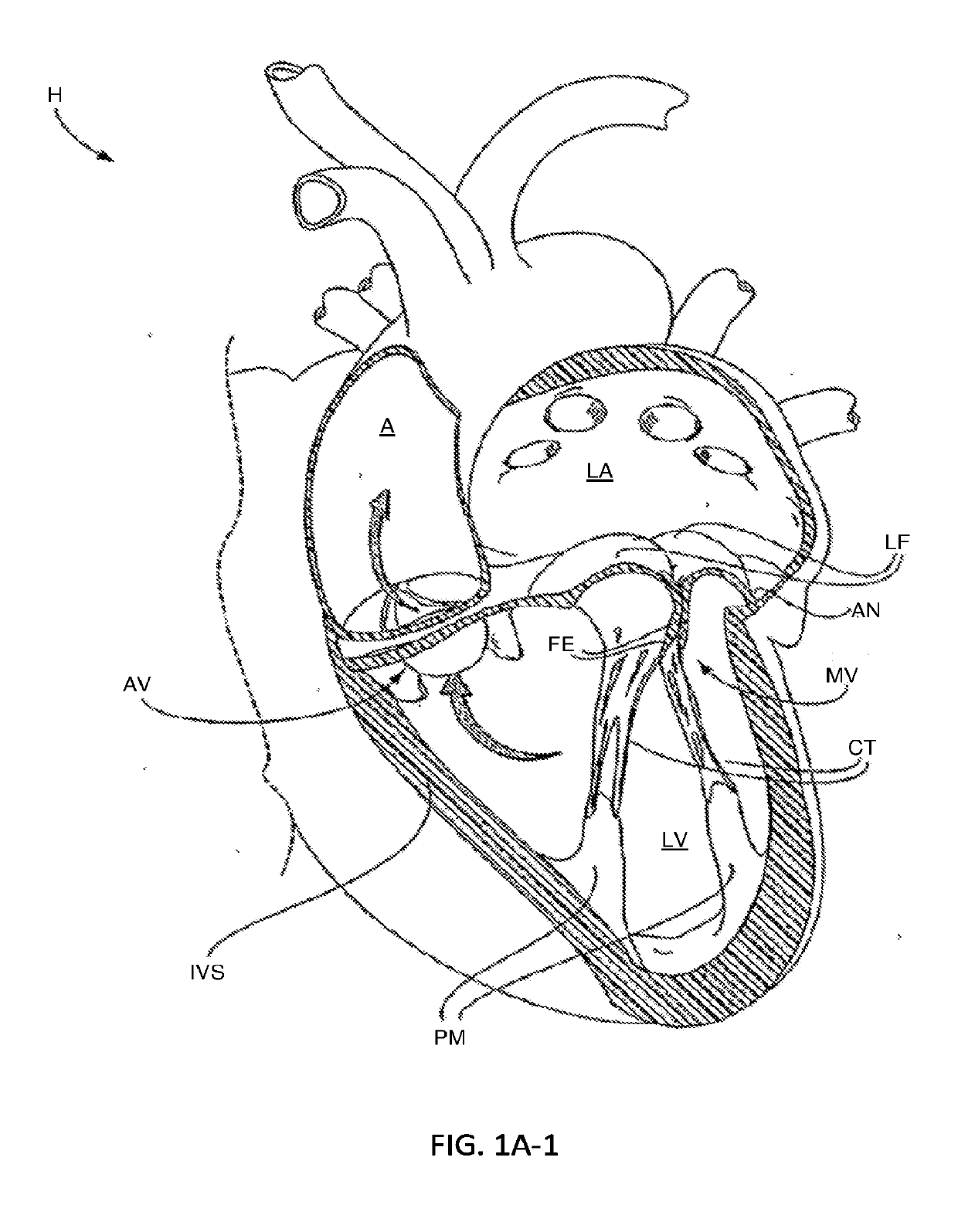 Tissue grasping devices and related methods