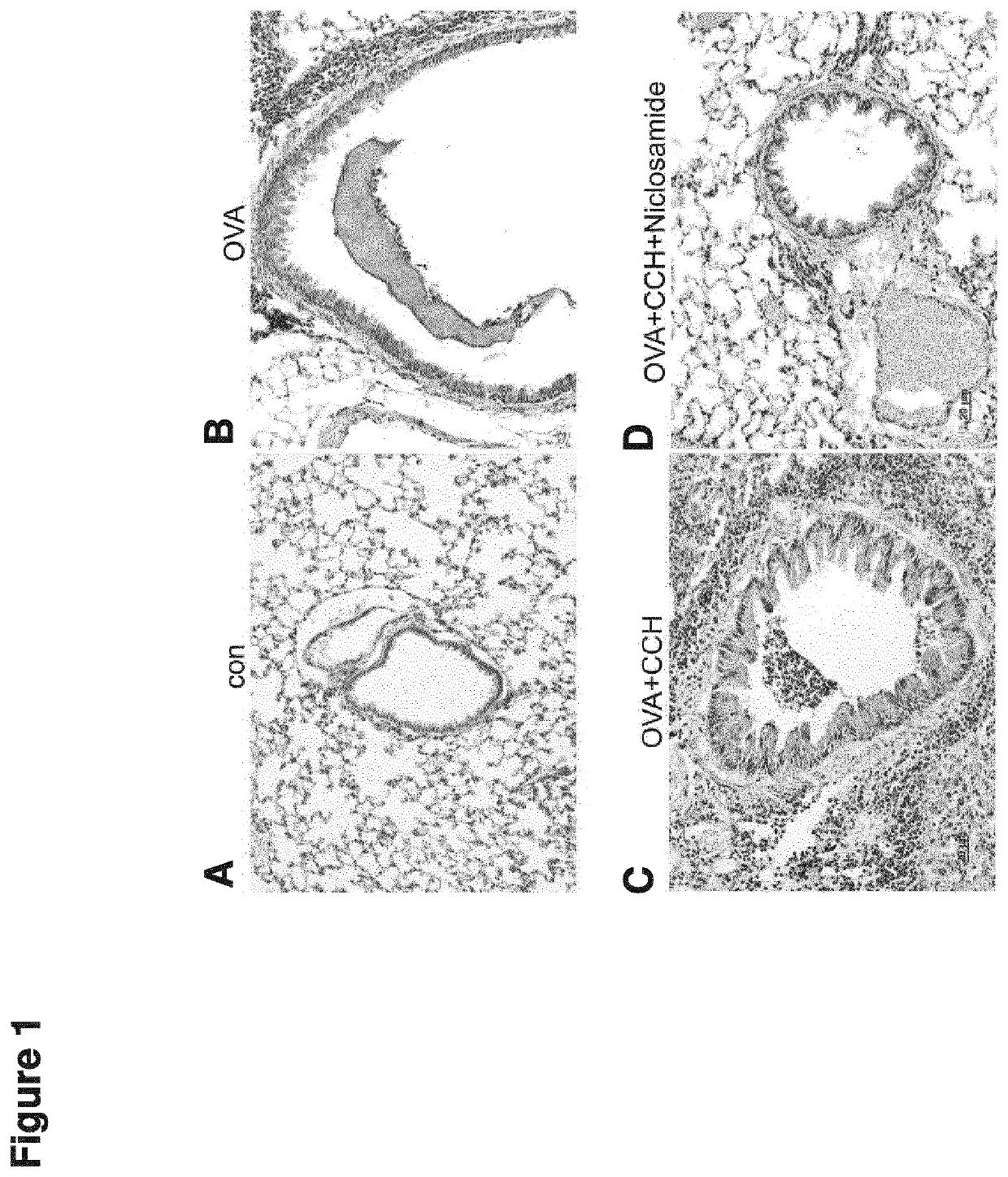 Compound for use in the treatment of a disease characterized by dysregulated mucus production and/or secretion