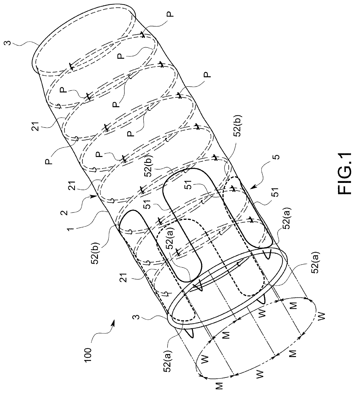 Stent-graft