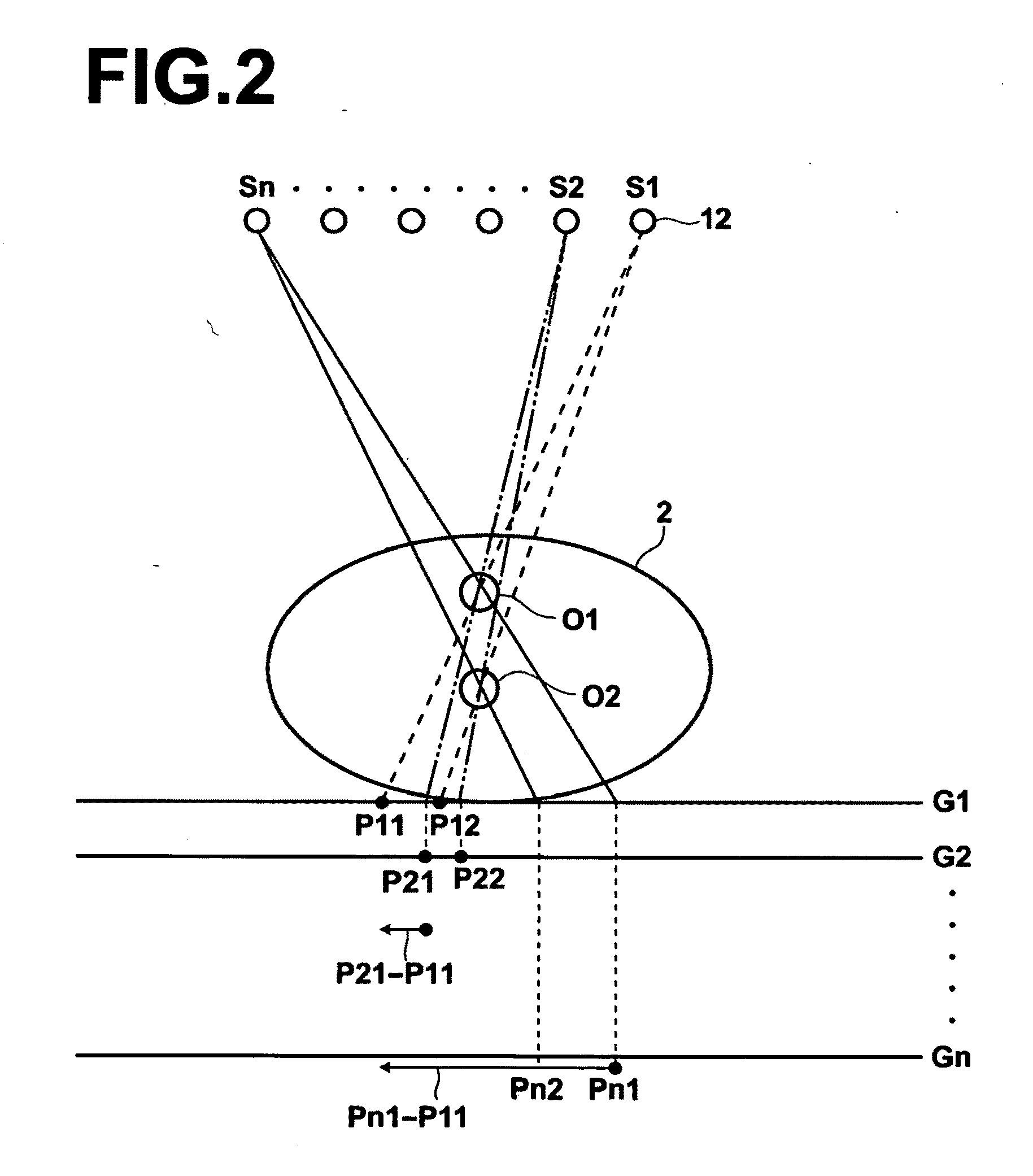 Radiography apparatus