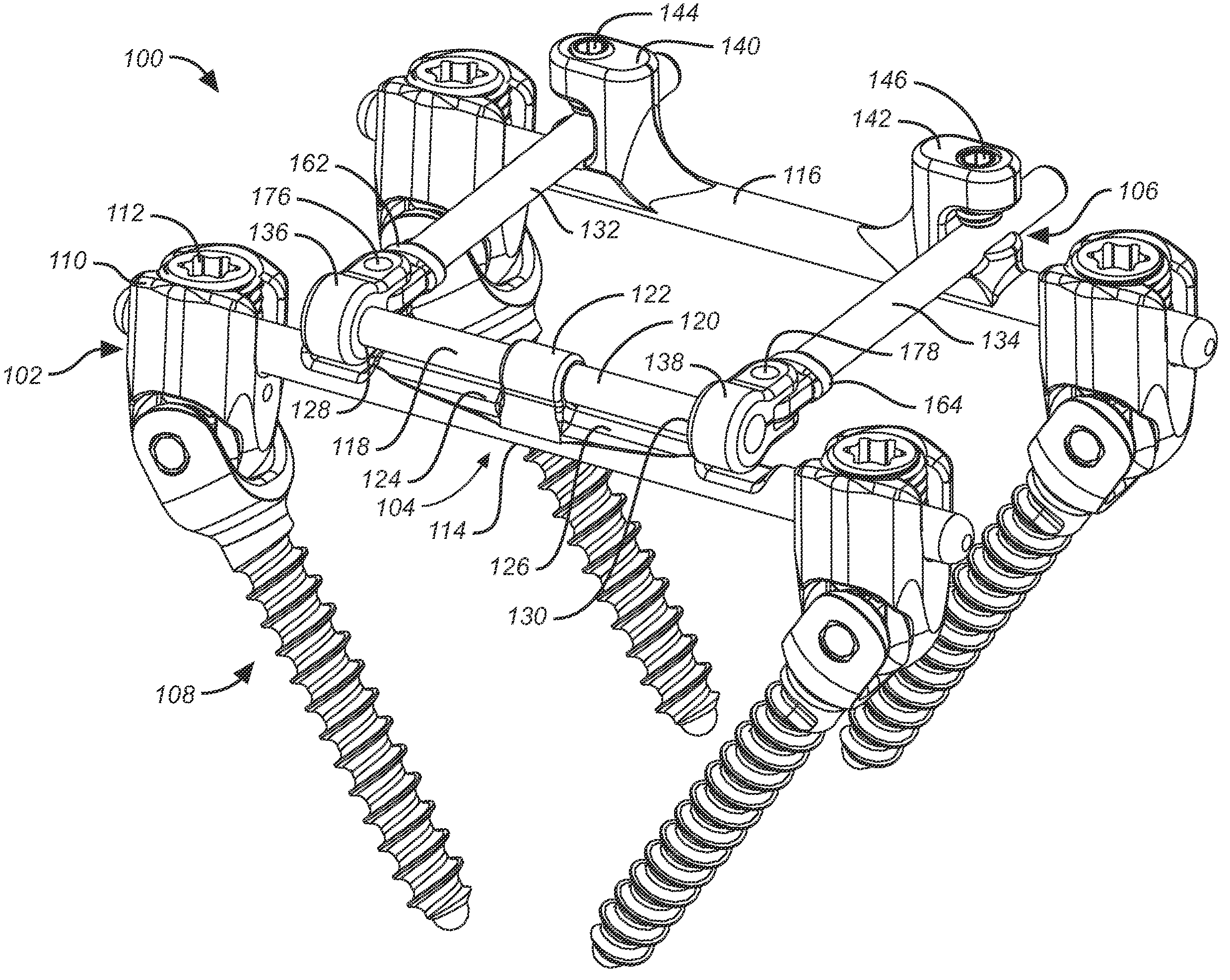 Bone anchor with a yoke-shaped anchor head for a dynamic stabilization and motion preservation spinal implantation system and method