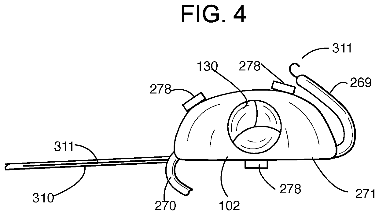 Distal subannular anchoring tab for side-delivered transcatheter valve prosthesis