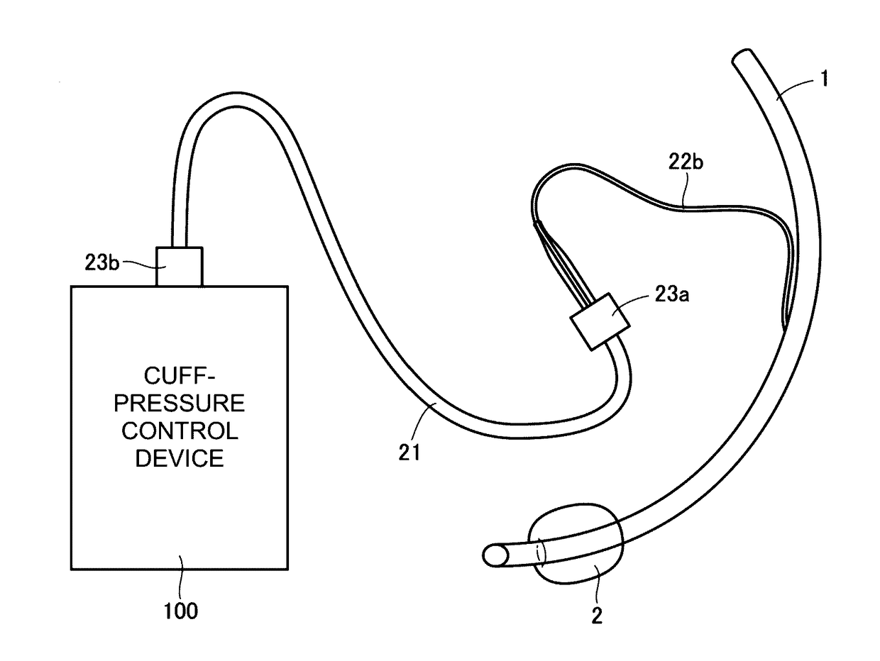 Cuff-pressure control device, cuffed tracheal tube, respirator, and obstruction detection method