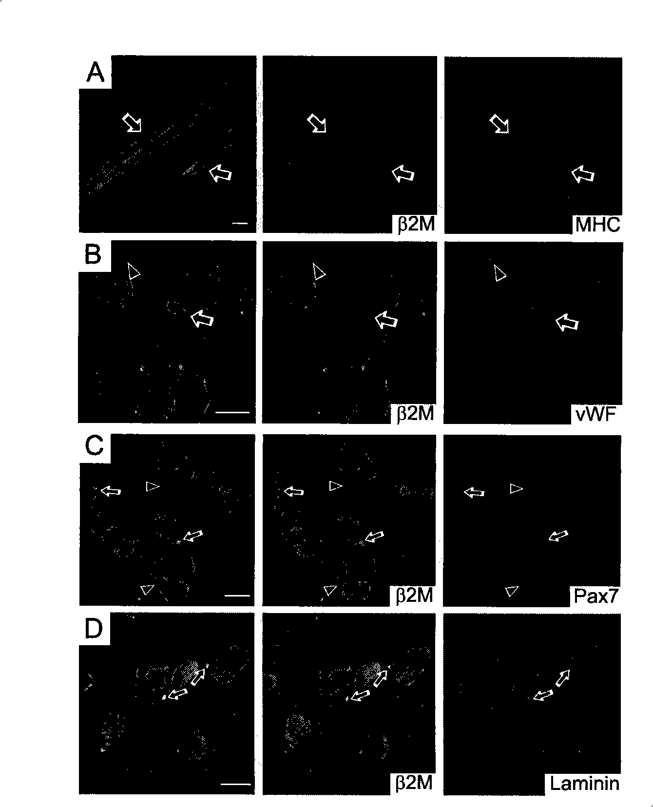 Method for isolated culture of human fat mesenchyma stem cell and special culture medium thereof