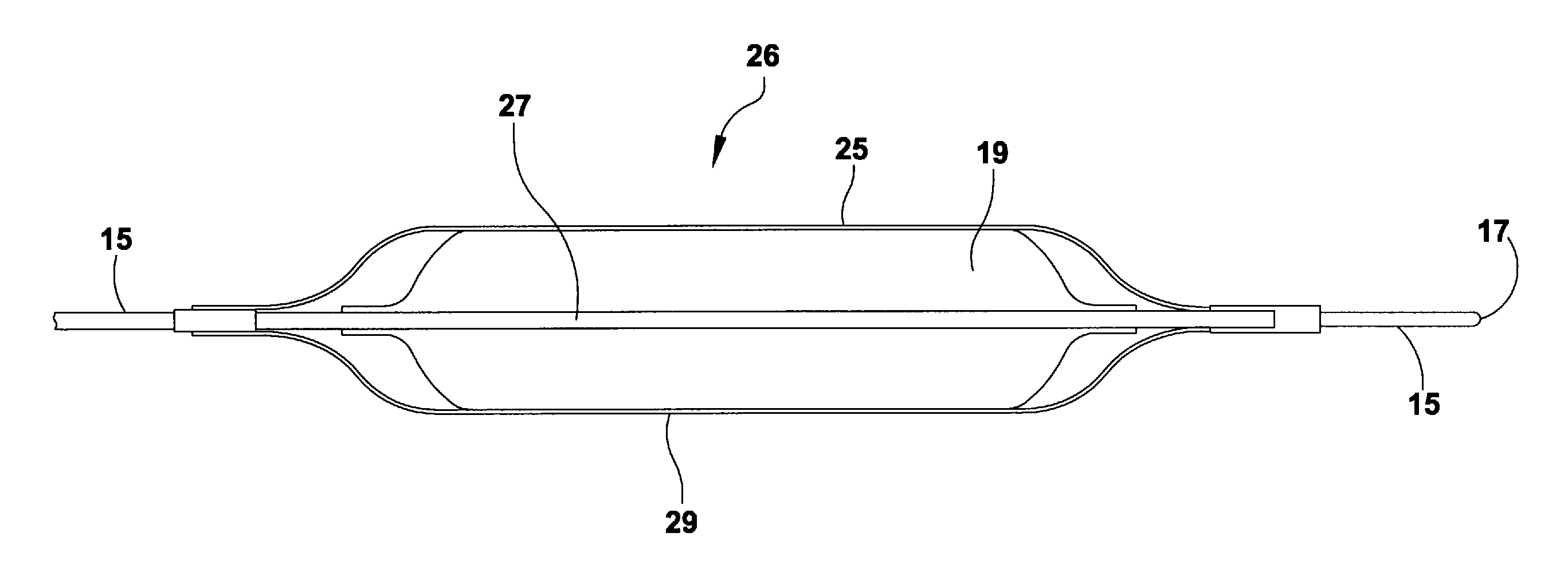 Method for Treatment of Complications Associated with Arteriovenous Grafts and Fistulas Using Electroporation